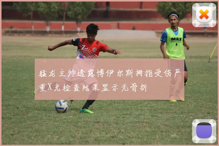 猛龙主帅透露博伊尔斯拇指受伤严重X光检查结果显示无骨折